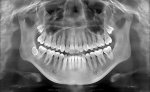 dental-xrays-port-washington-ny-1-768x469.jpg