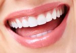 about-porcelain-veneers.jpg