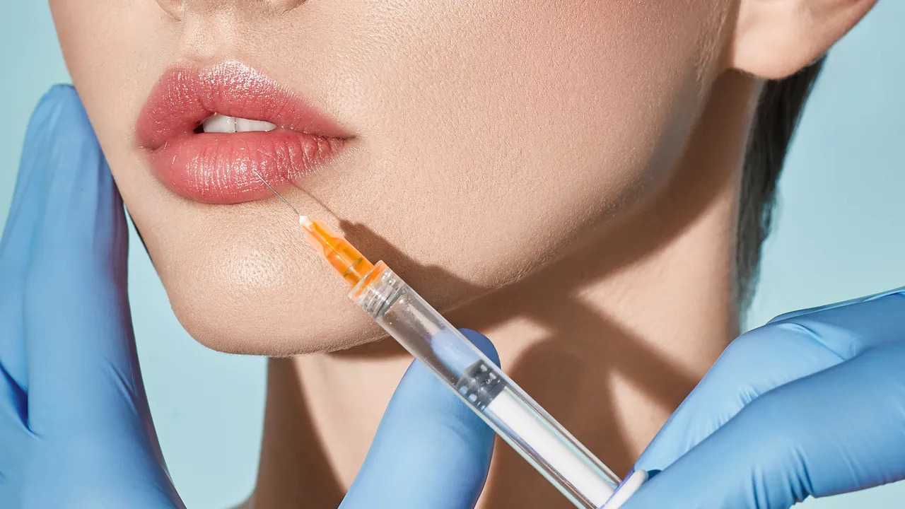 Non-surgical lip augmentation with dermal fillers - Hush LA Medspa